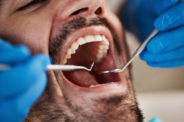Full Mouth Reconstruction in Saranac Lake, NY